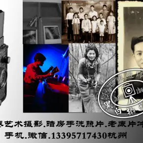 【图】鼻小柱是哪里鼻小柱的位置在哪里(图1)